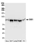Detection of human and mouse CSE1 by western blot.