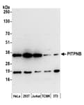 Detection of human and mouse PITPNB by western blot.