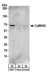 Detection of human CaMKK2 by western blot.