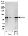 Detection of human NUMB by western blot.