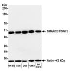 Detection of mouse SMARCB1/SNF5 by western blot.