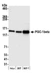 Detection of human PGC-1beta by western blot.