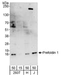 Detection of human Prefoldin 1 by western blot.