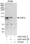 Detection of human CHD1L by western blot of immunoprecipitates.