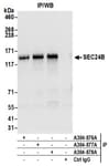 Detection of human SEC24B by western blot of immunoprecipitates.
