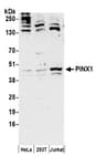 Detection of human PINX1 by western blot.