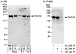 Detection of human and mouse DHX38 by western blot (h&amp;m) and immunoprecipitation (h).