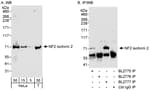 Detection of Isoform 2 of human NF2 by western blot and immunoprecipitation.