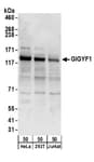 Detection of human GIGYF1 by western blot.