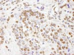 Detection of mouse PHF8 by immunohistochemistry.