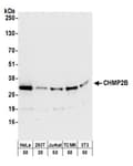 Detection of human and mouse CHMP2B by western blot.
