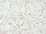 Detection of mouse SMARCB1/SNF5 by immunohistochemistry.
