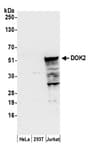 Detection of human DOK2 by western blot.
