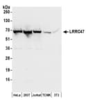 Detection of human and mouse LRRC47 by western blot.