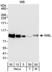 Detection of human and mouse NIBL by western blot.