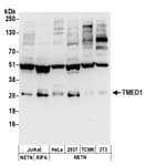 Detection of human and mouse TMED1 by western blot.
