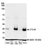 Detection of human CTLA4 by western blot.