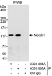 Detection of human Notch1 by western blot of immunoprecipitates.