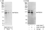 Detection of human PDE3A by western blot and immunoprecipitation.