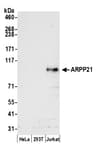 Detection of human ARPP21 by western blot.