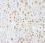Detection of mouse SMARCC2/BAF170 by immunohistochemistry.
