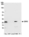 Detection of human and mouse CRIP2 by western blot.