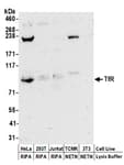 Detection of human TfR by western blot.