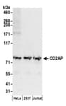 Detection of human CD2AP by western blot.