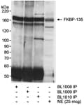 Detection of human FKBP-135 by western blot and immunoprecipitation.