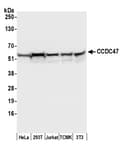 Detection of human and mouse CCDC47 by western blot.
