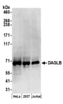 Detection of human DAGLB by western blot.