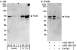 Detection of human and mouse RelB by western blot (h&amp;m) and immunoprecipitation (h).