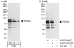 Detection of human PDE4D by western blot and immunoprecipitation.