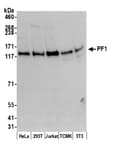 Detection of human and mouse PF1 by western blot.