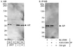 Detection of human AIP by western blot and immunoprecipitation.