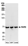 Detection of human RARS by western blot.