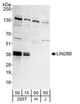Detection of human LIN28B by western blot.
