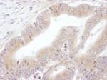 Detection of human eIF3E by immunohistochemistry.