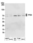 Detection of human and mouse TFE3 by western blot.