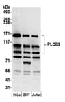 Detection of human PLCB3 by western blot.
