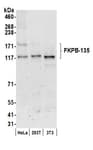 Detection of human and mouse FKPB-135 by western blot.