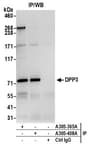 Detection of human DPP3 by western blot of immunoprecipitates.