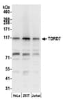Detection of human TDRD7 by western blot.