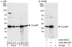 Detection of human and mouse CacyBP by western blot (h&amp;m) and immunoprecipitation (h).