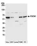 Detection of human and mouse FSCN1 by western blot.