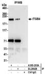 Detection of human ITGB4 by western blot of immunoprecipitates.