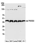 Detection of human and mouse PDCD2 by western blot.