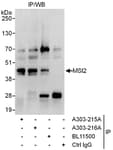 Detection of human MSI2 by western blot of immunoprecipitates.