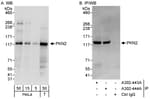 Detection of human PKN2 by western blot and immunoprecipitation.