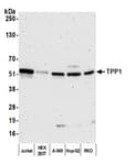Detection of human TPP1 by western blot.